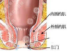 肛门瘙痒表现以及治疗方法？